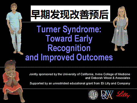 tuner syndrome3.jpg