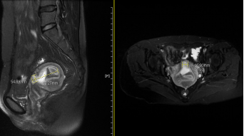 MRI.png