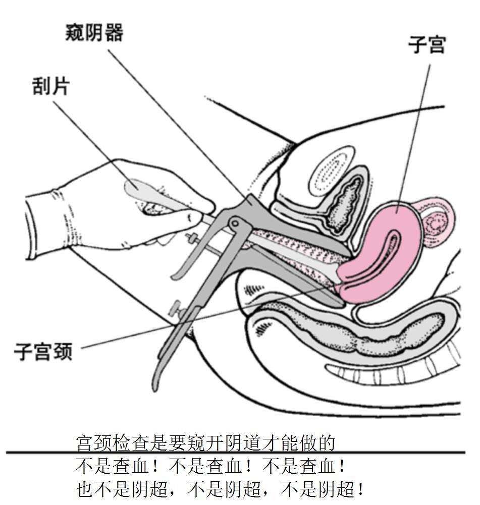 QQ截图20170330212540.jpg
