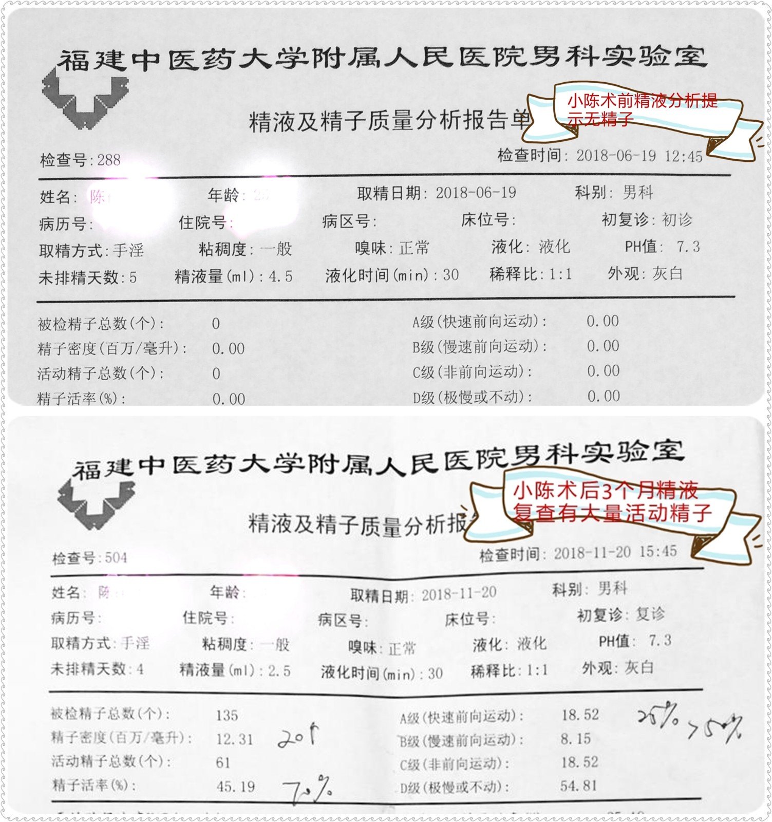 小陈术前与术后精液分析对照图_副本.jpg