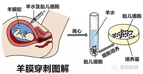 羊膜囊-8.jpg