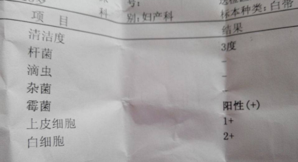 霉菌 的白带图片.png