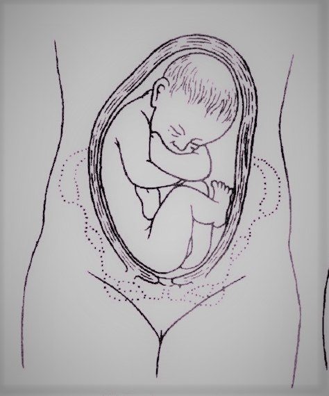住房不合适是臀位最主要的原因——    子宫腔的大小和胎儿大小不