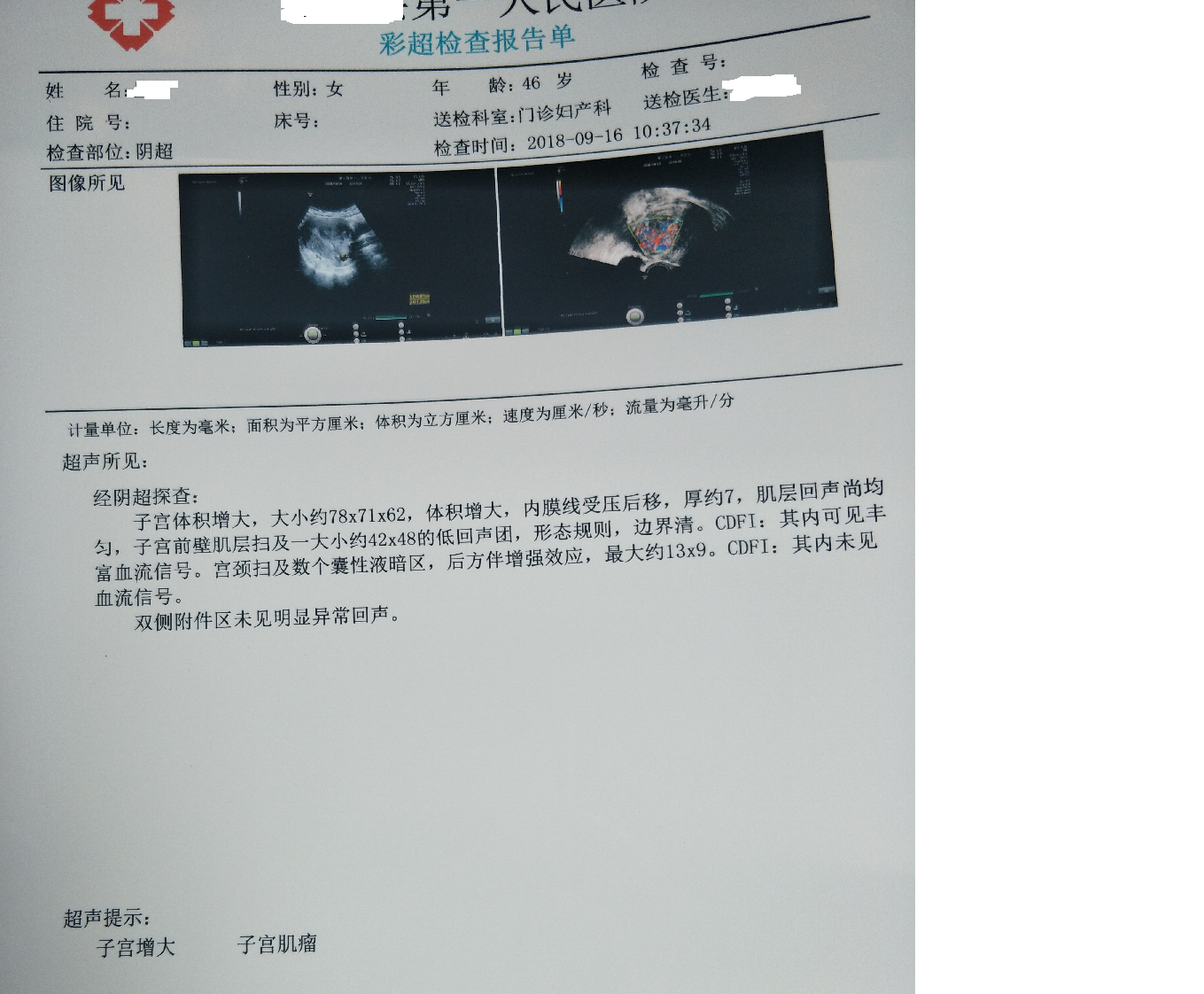 yue qiu bc.png
