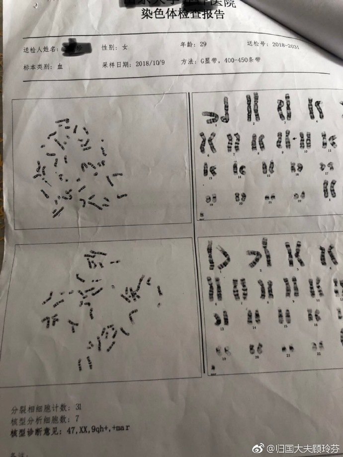 chromosome report.jpg