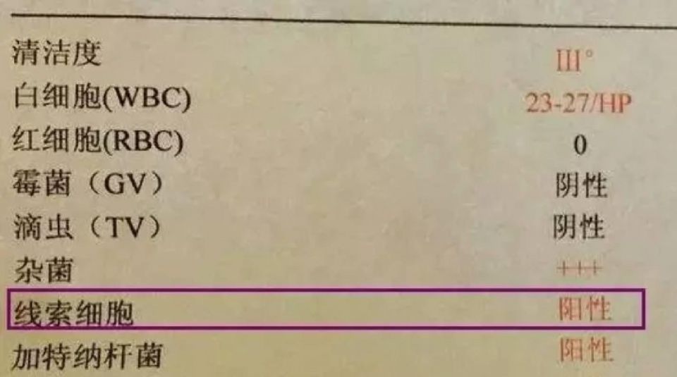 BV 特征白带.jpg