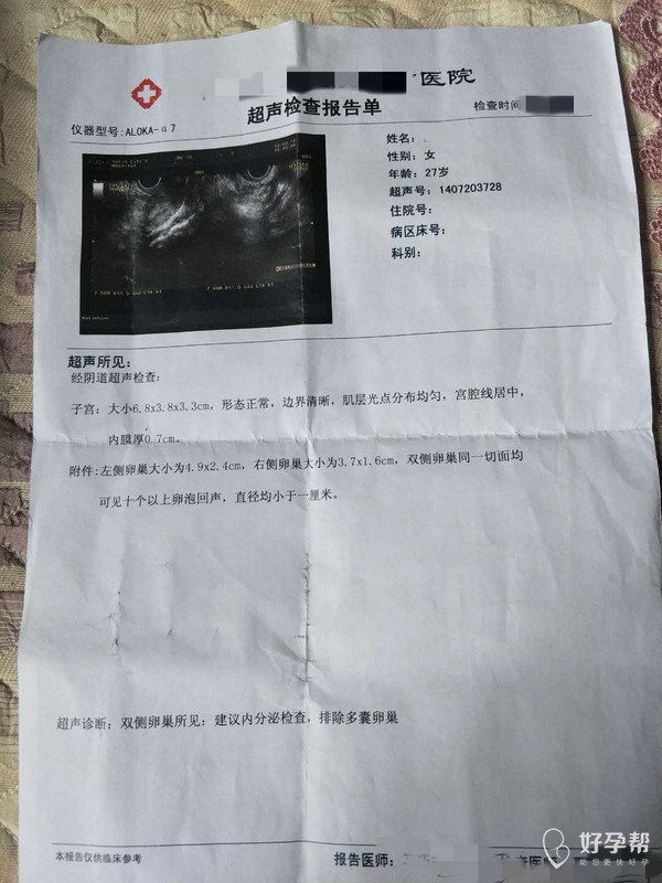 什么时候检查内分泌比较好 gw-topic