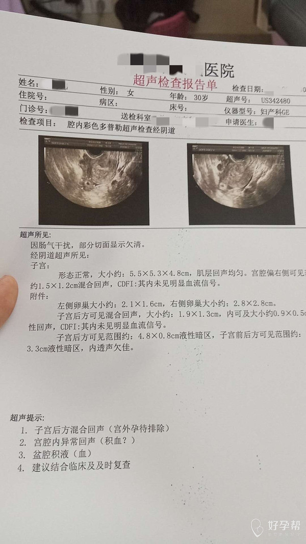 刚不久做的宫外孕,左边没保留了输卵管 还能用