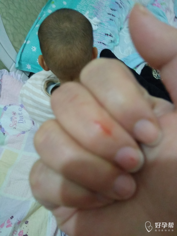 早上起来拆奶粉划到手了01