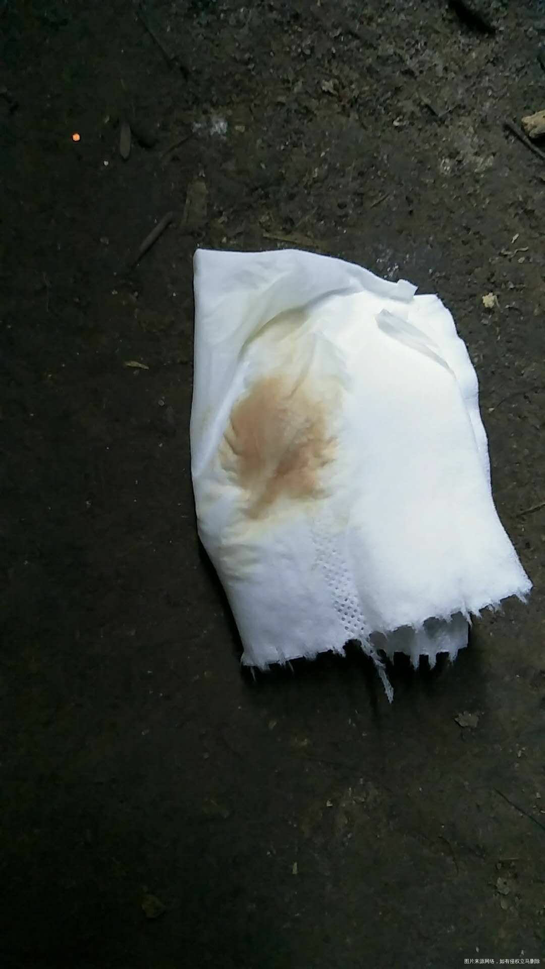 大姨妈为什么是黑色的 大姨妈为什么是黑色的