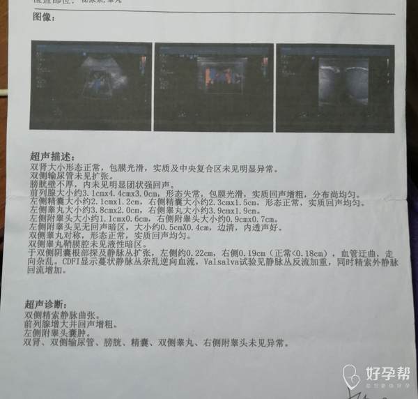 麻烦在线医生进来看看:
老公自从两年前做