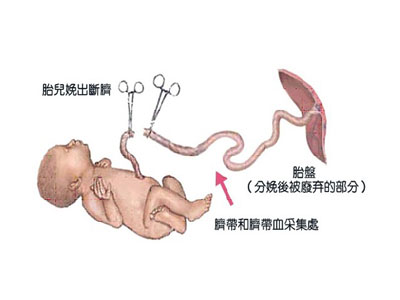 婴儿脐带连接母体图图片