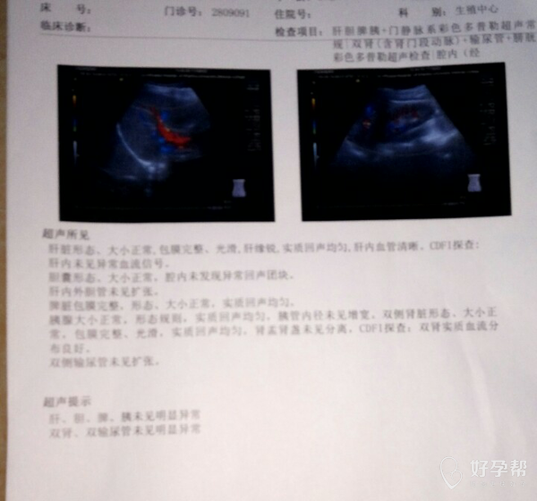 15017693092913.jpg@!gw-topic