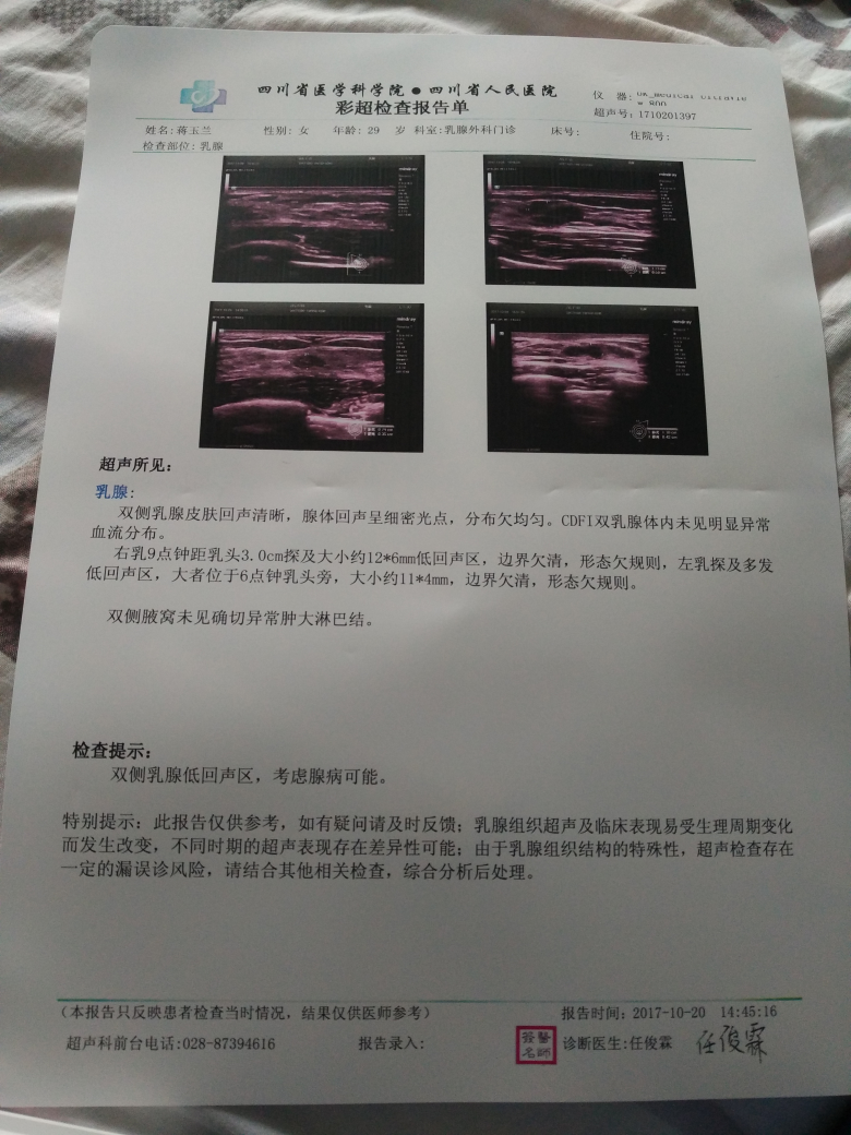 乳腺增生的彩超图片图片