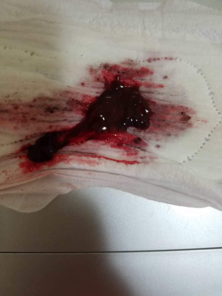 正常的经血图卫生巾图片