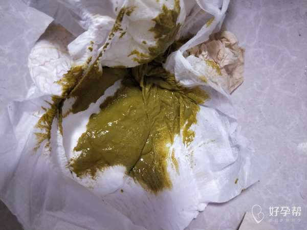宝宝喝奶粉拉这样的便便正常吗