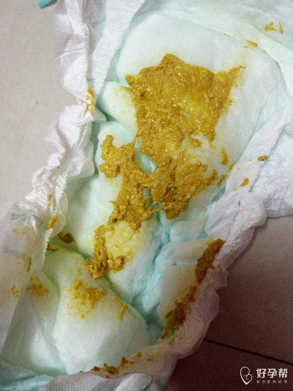 宝宝46天已经拉水样便四五天了