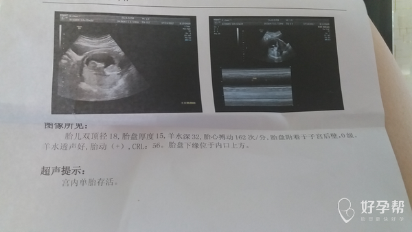 肚子脂肪厚度标准 gw-topic