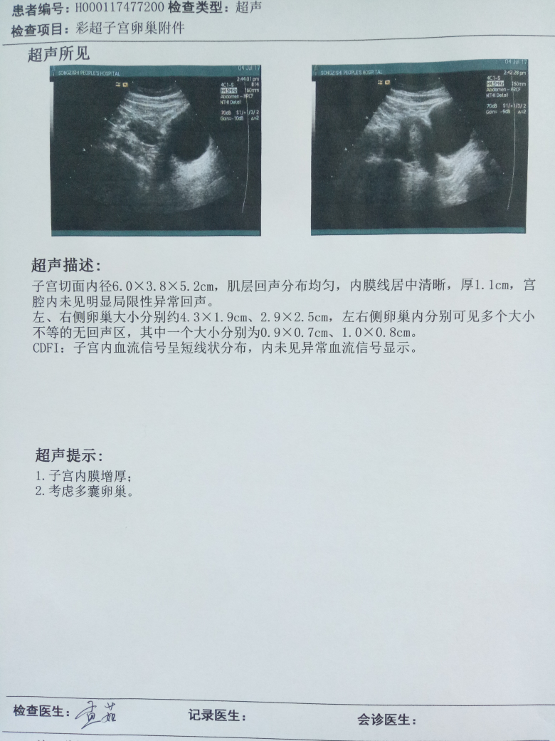 子宫偏左图片