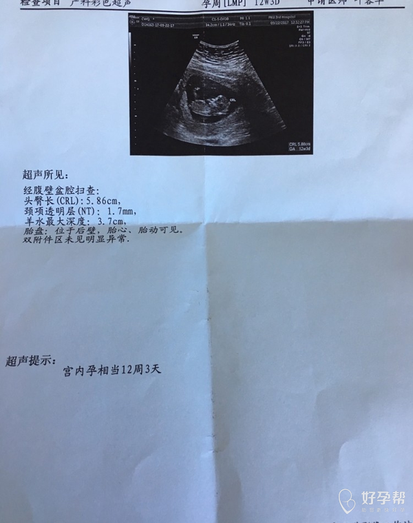 中药怎么调理多囊 gw-topic