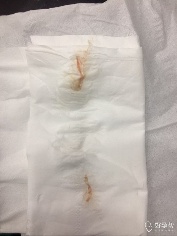 出血一点点 急!急!急!8周.