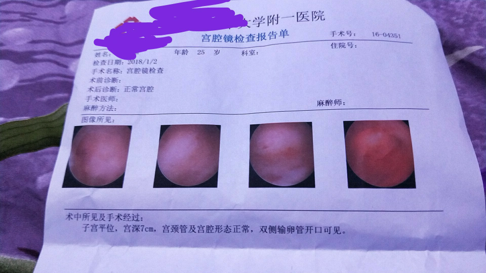 今天做的宫腔镜检查帮忙看看