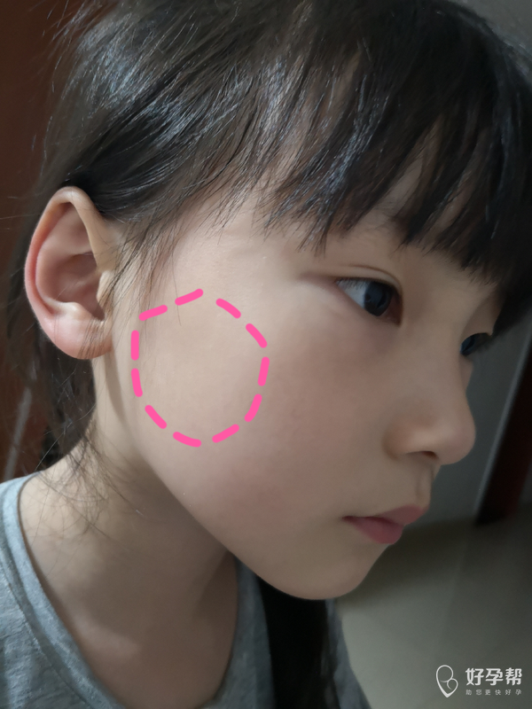 7岁孩子脸颊痛,用手摸里面有个小包