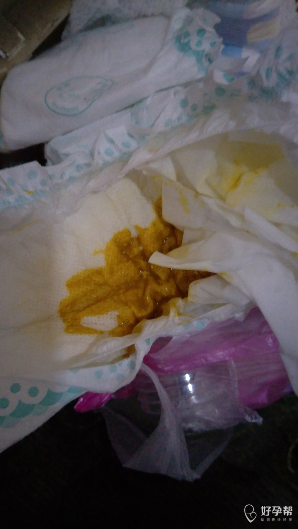 宝宝拉屎正常吗请问医生