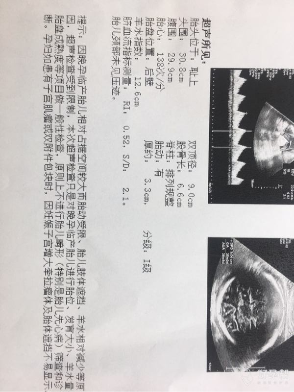 新生儿什么时候可以做b超 gw-topic