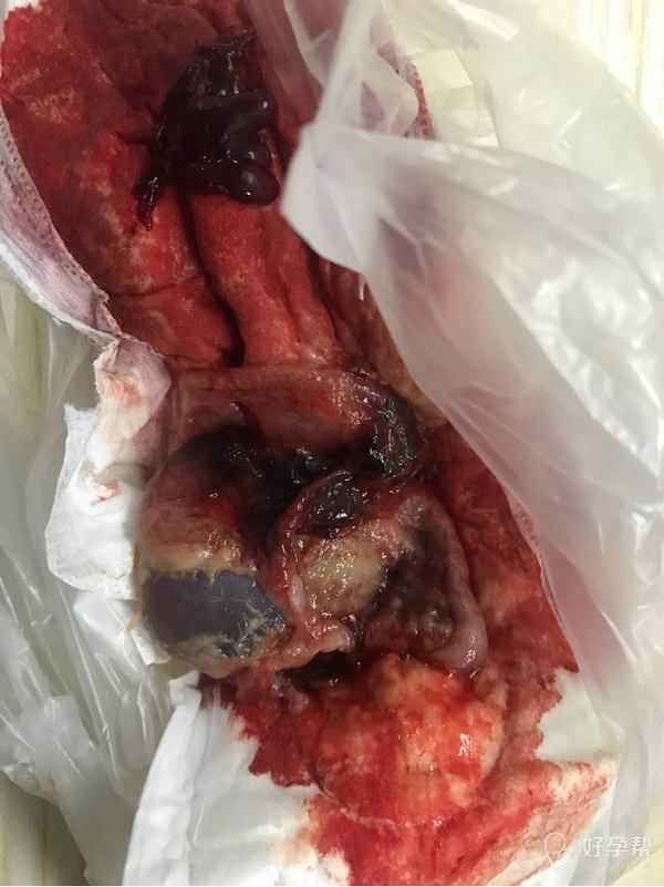 今晚流出来的,是怀孕了吗?