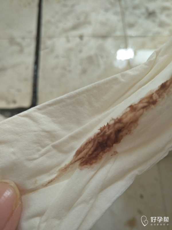 请问医生这是什么情况?