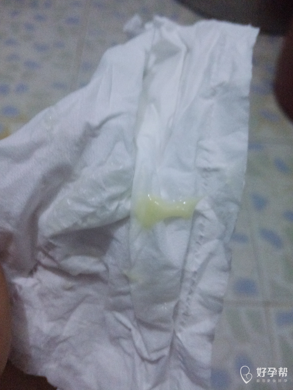 白带有点浅浅绿色什么情况?