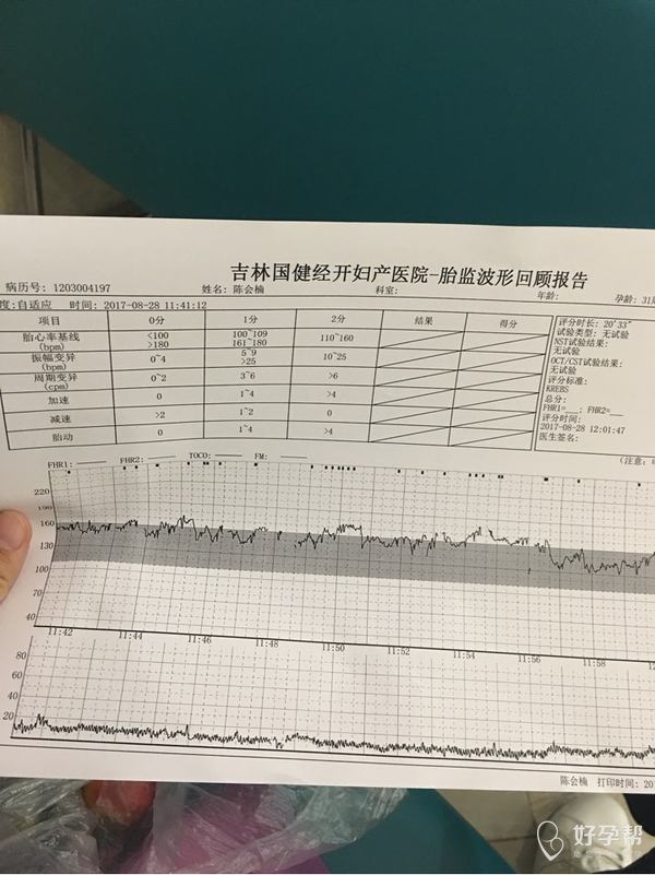 看看胎心監護和四維單子