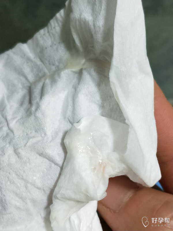 这是什么?求姐妹们解答-备孕心情-备孕交流论坛-好孕帮