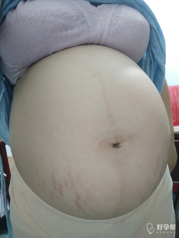 看看我这肚子大不大,肚子感觉像篮球一样-好孕妈妈圈-好孕帮