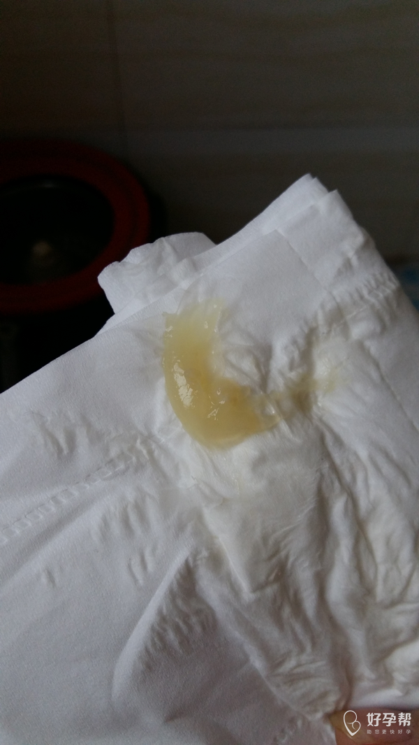 白带多-好孕妈妈论坛-好孕帮