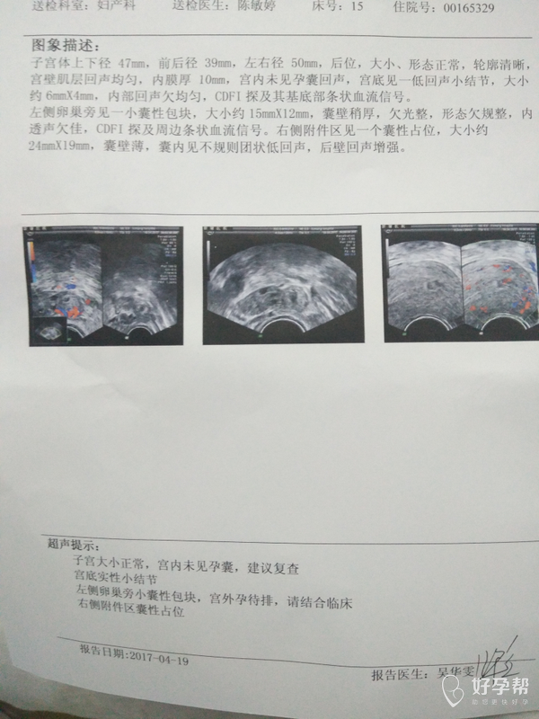 前三天做陰超都沒有寫宮底實性小結節,今天有寫,會不會是孕囊呢?