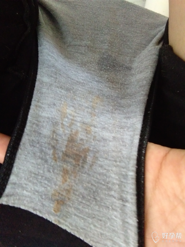 月经推迟五天了!请大家告诉我是怎么回事?是月经有问题还是怎么样