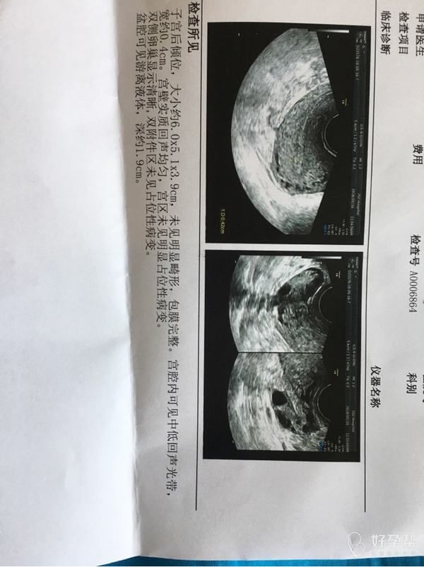 几个月出现一次血便 gw-topic