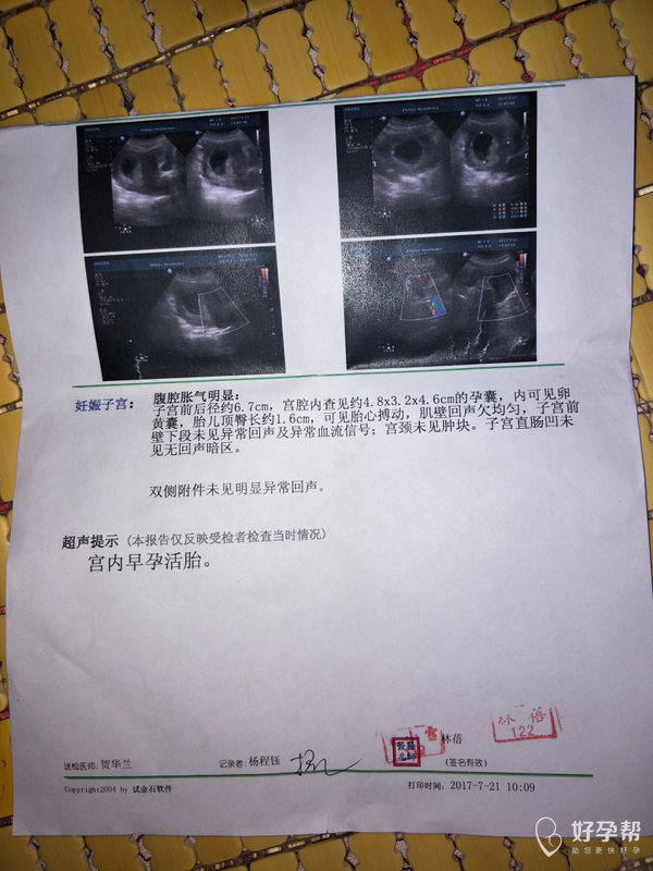 怀孕56天下面见红严重吗