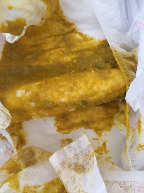 【恶心便便】请求医生帮忙看看