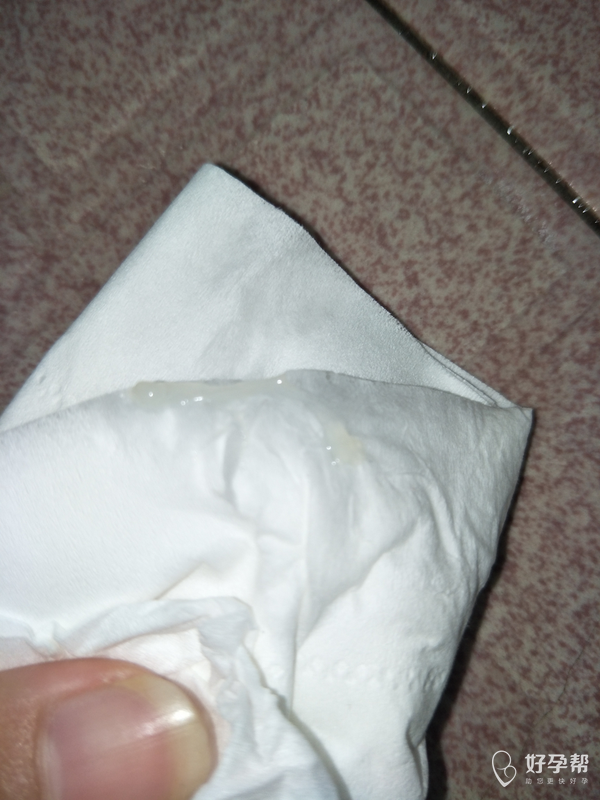 刚刚上厕所看到的,这样子是拉丝嘛?