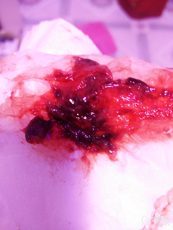 月经推迟半个月今天来了晚上排出来一块肉体