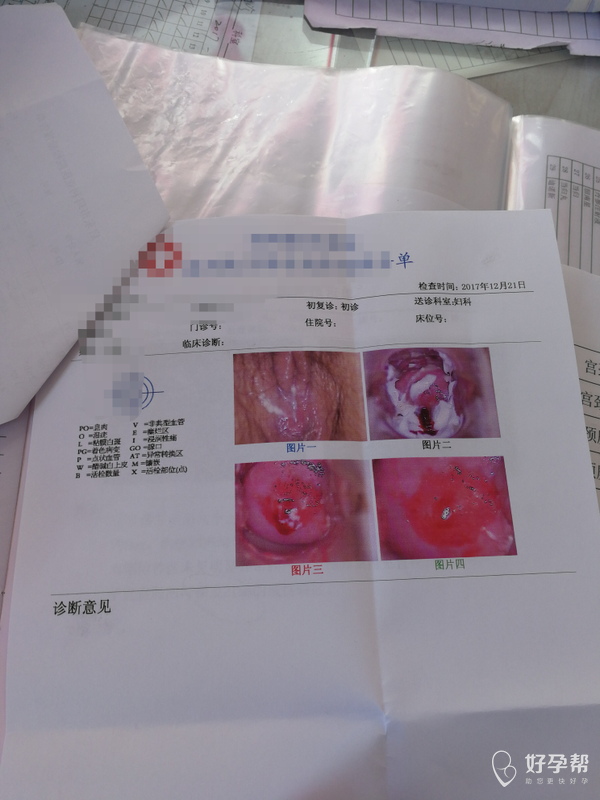 哎,今天去检查吓我一身冷汗,原来这么严重