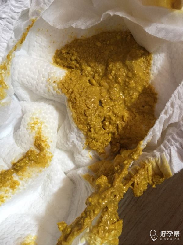 20天bb的,帮忙看看正常吗