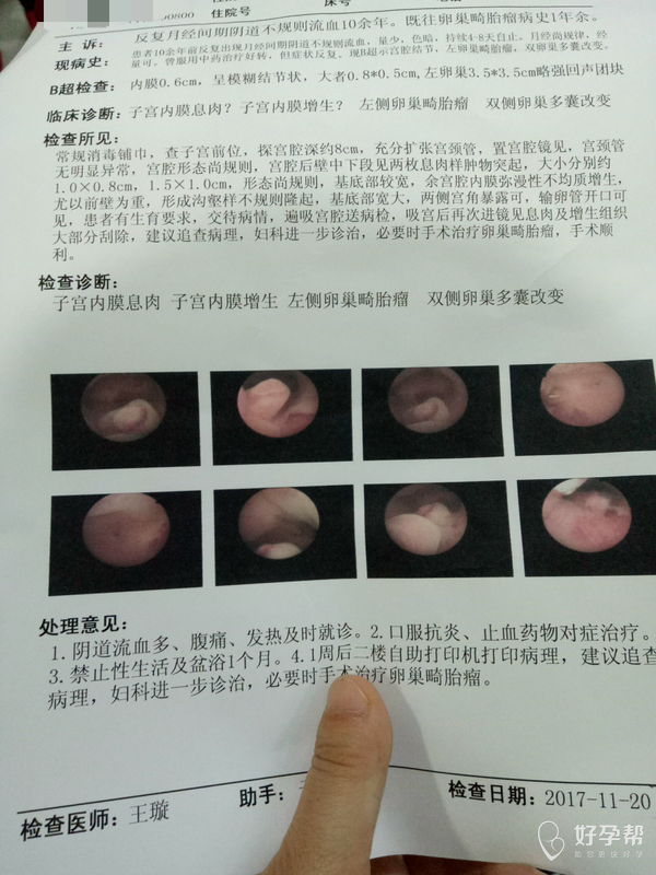 请医生帮我看看什么时候去做彩超检查合适