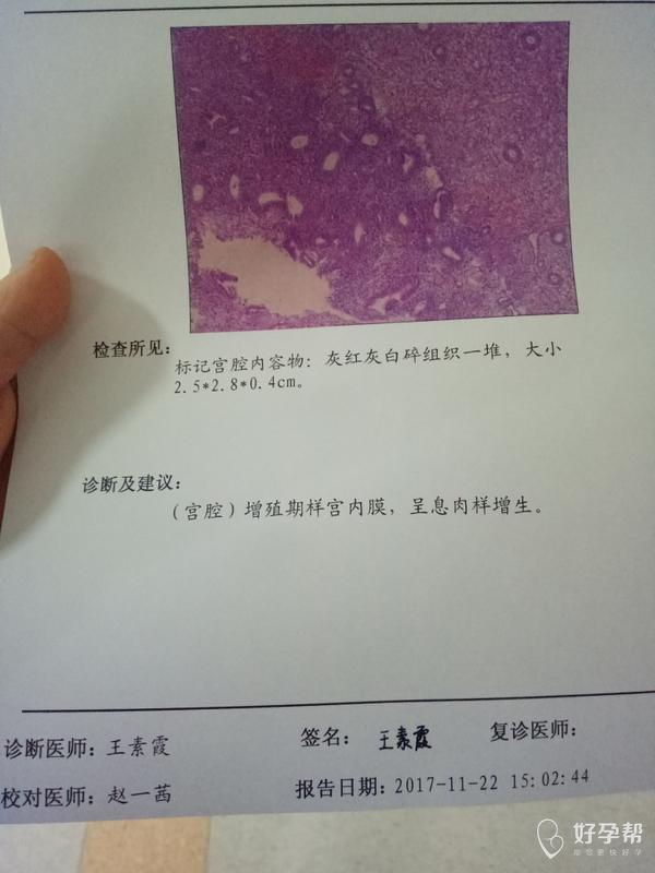 20做的宫腔镜检查,有割掉息肉送检,病理也出来了,12.