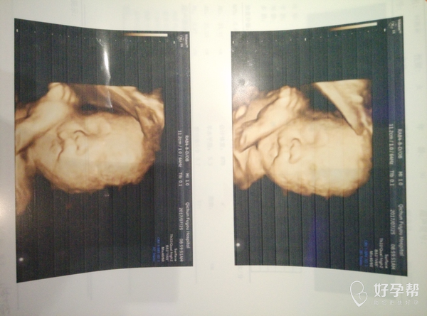 一般几个月做四维 gw-topic