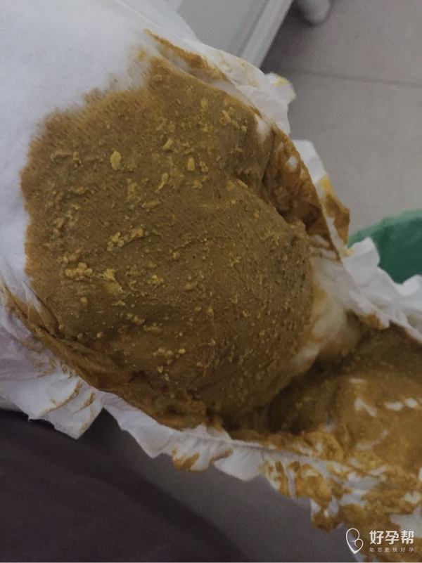 宝宝大便颗粒状,怎么回事?