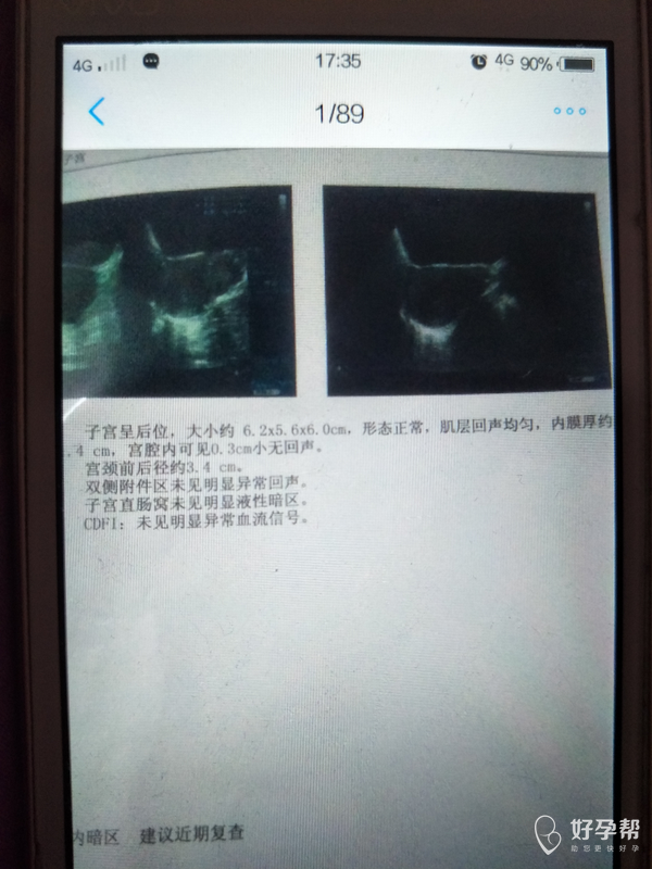 什么时候检测出怀孕 gw-topic